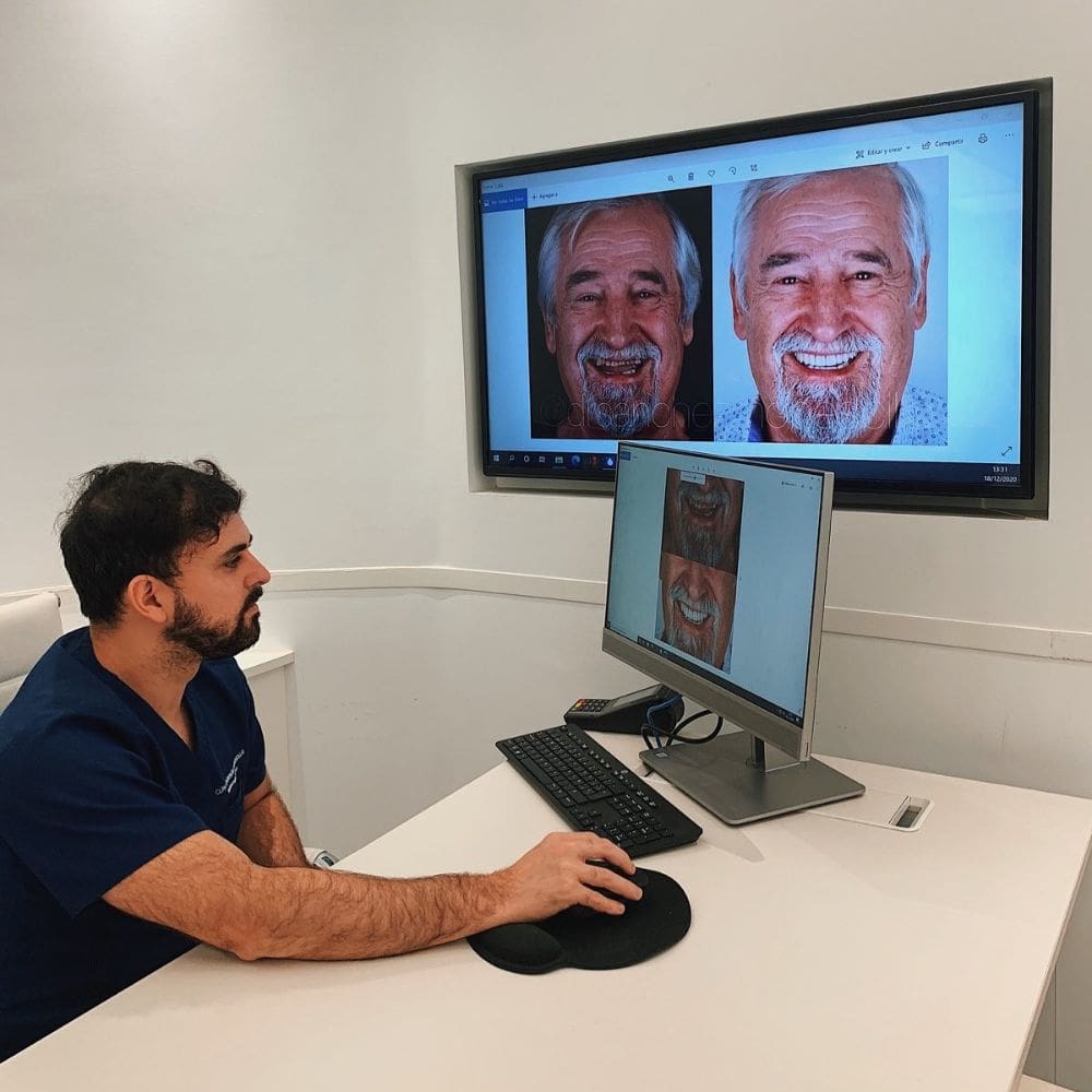 Turrion Monescillo Clinica dental y diseno de sonrisa – Madrid – La Moraleja Madrid